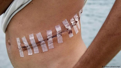 Тунист хүний эрхтэн наймаалдаг сүлжээг илрүүлжээ