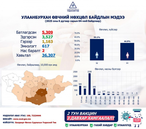 Улаанбурхан өвчний лабораториор батлагдсан тохиолдол 5309 болжээ